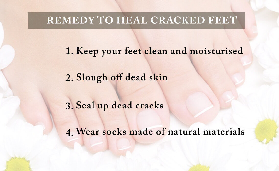 home remedies for cracked heels
