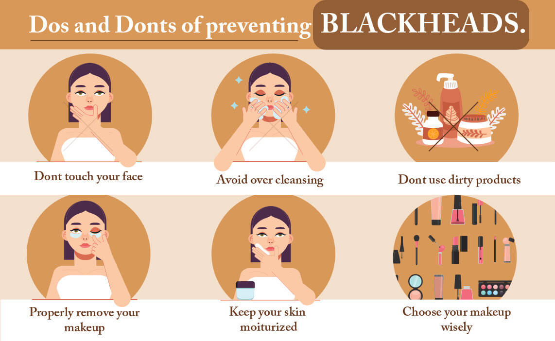 how to prevent blackheads